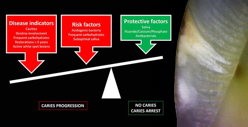 Caries risk diagram